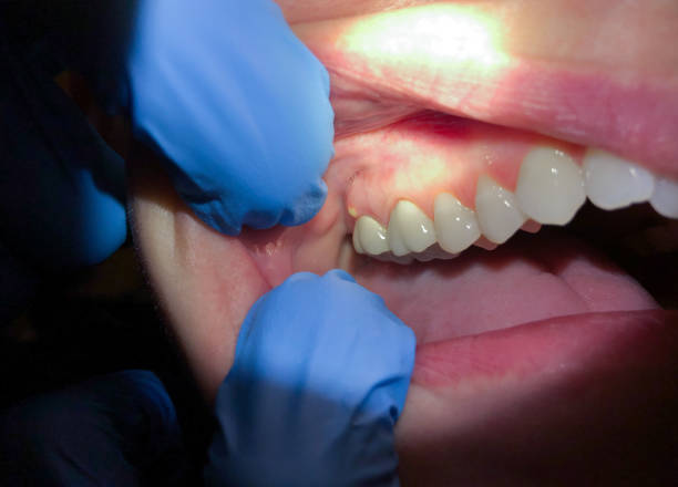 Best Emergency Orthodontic Repairs in Bayou Blue, LA