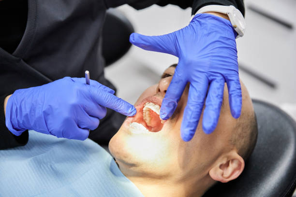 Best Emergency Tooth Extraction in Bayou Blue, LA